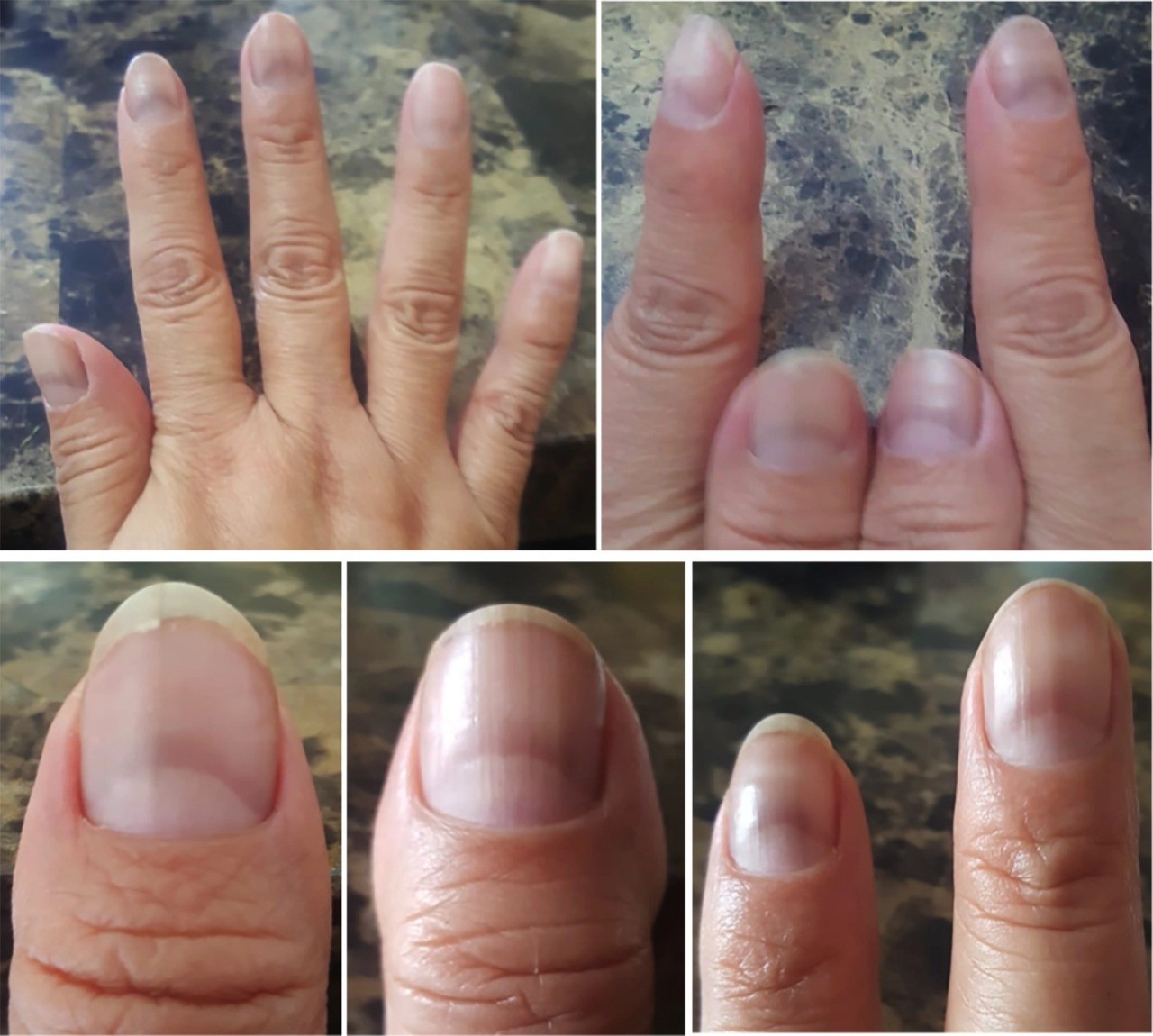 Como a Teoria das Unhas Vermelhas pode Influenciar sua Vida Amorosa