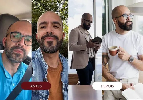 erros comuns no visagismo capilar masculino